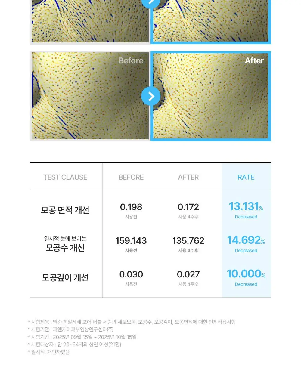 [올리브영 한정기획] 믹순 히알레배 포어 버블 세럼 70ml 기획 (+늘어나는 쫀득솜 35매) 상세페이지 33